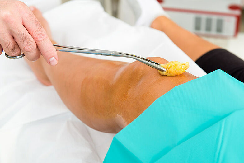 Desinfektion des OP-Bereiches bei einer Knie-Operation.
